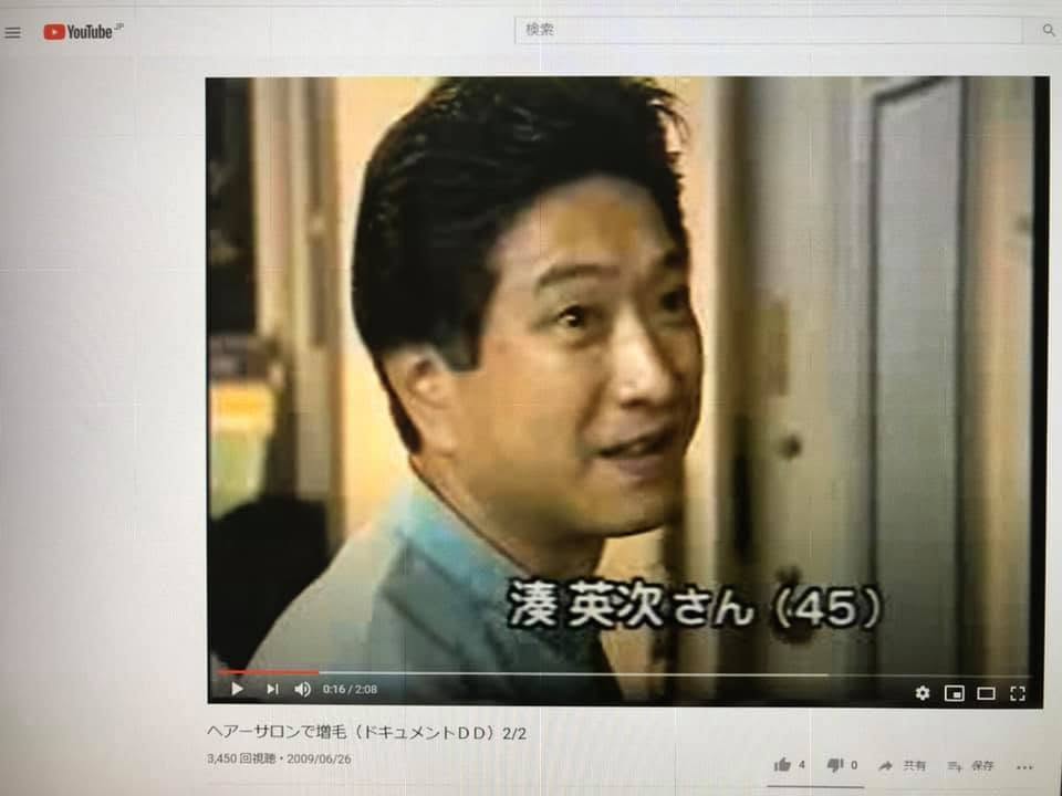 約30年前にテレビ番組の取材を受けた特許増毛協会会長。現在も現役で施術を続けている。
