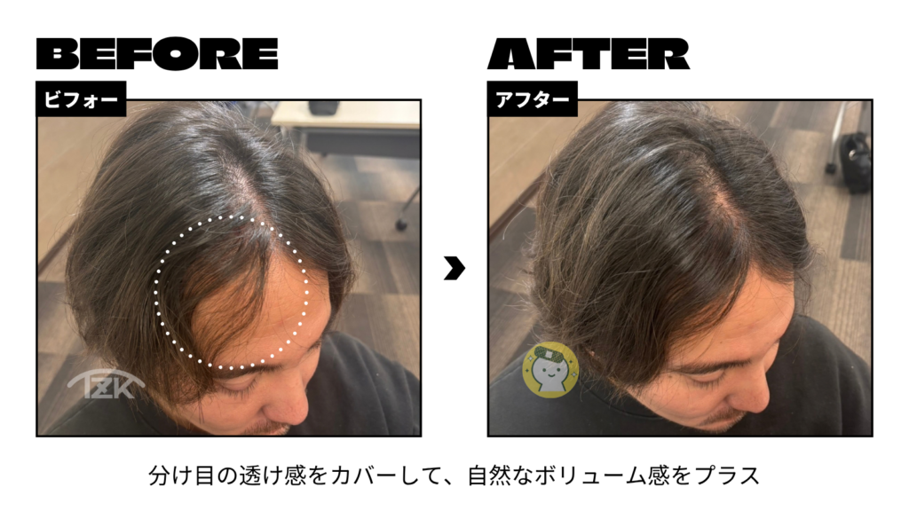 増毛エクステ施術前後の分け目の比較｜透け感をカバーして自然なボリューム感
